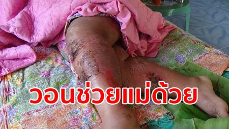 วอนช่วยแม่,โรคตุ่มน้ำพุพอง,ตุ่มน้ำใส,โรคประหลาด